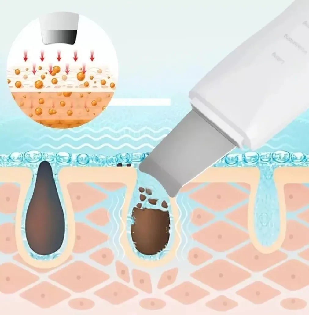Paleta Ultrasónica Limpiador Facial | Limpieza Profunda y Lifting